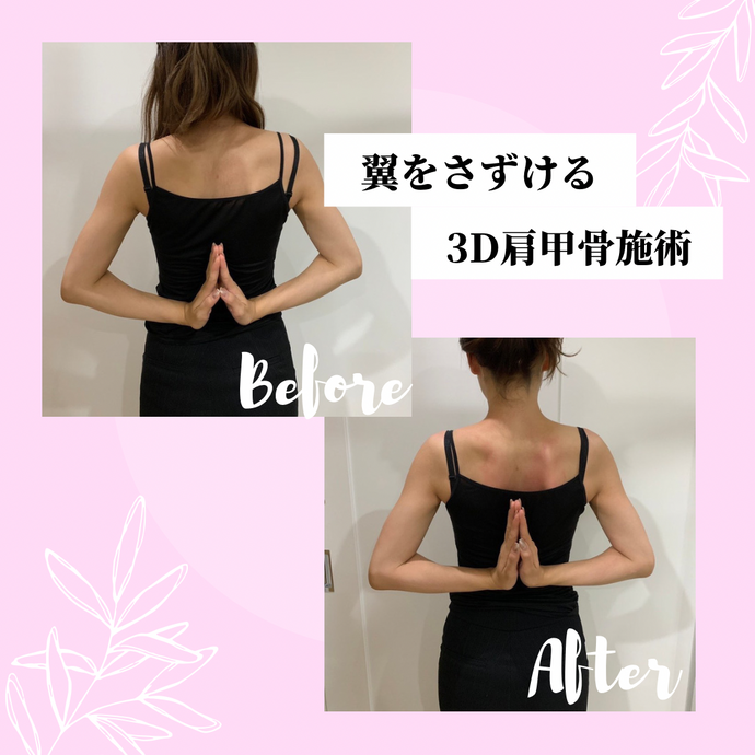 治療のご紹介〜３D肩甲骨〜