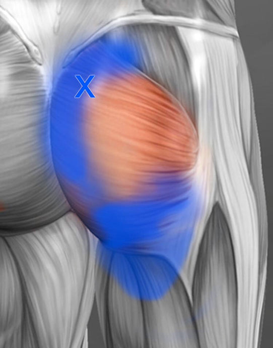 トリガーポイントpart.2