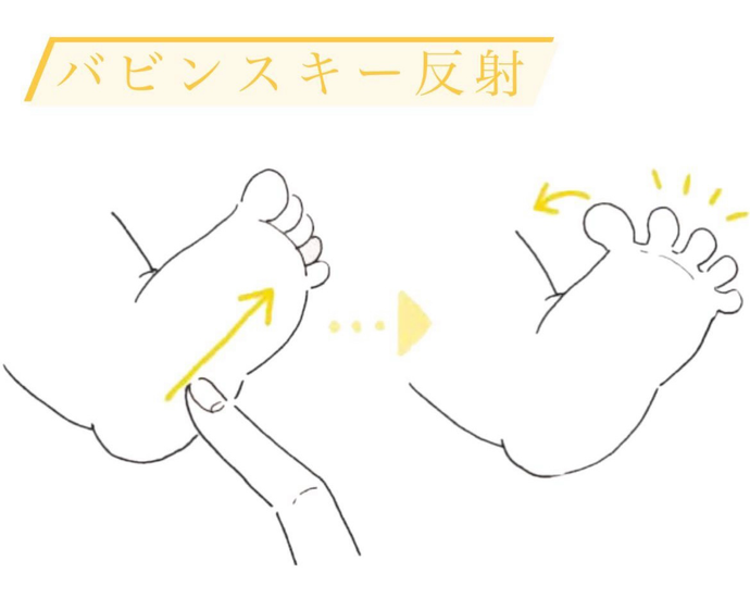 赤ちゃんの反射　part.1