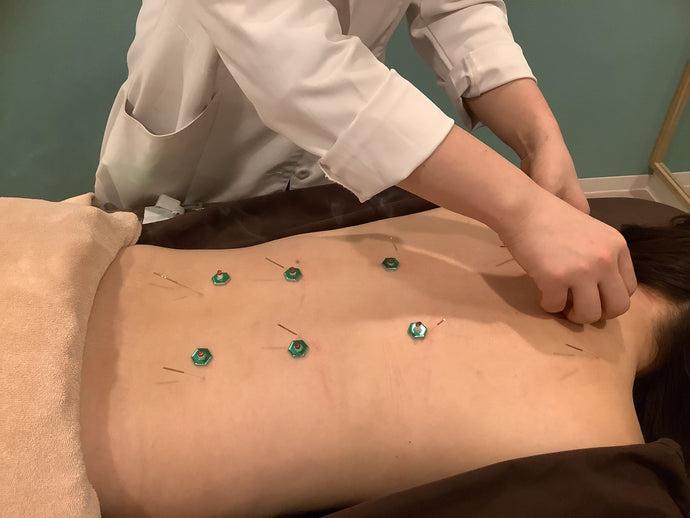 妊婦さんも通える鍼灸整骨院！