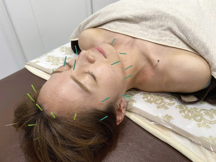 【ヒト幹細胞】と【美容鍼】