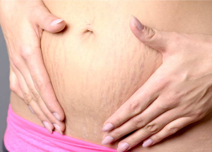 妊婦さんの保湿の重要性