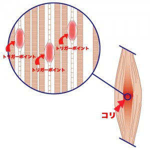 トリガーポイントとは？