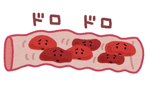 瘀血（オケツ）とは？